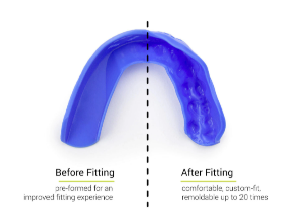 Sisu 3D Mouth Guard